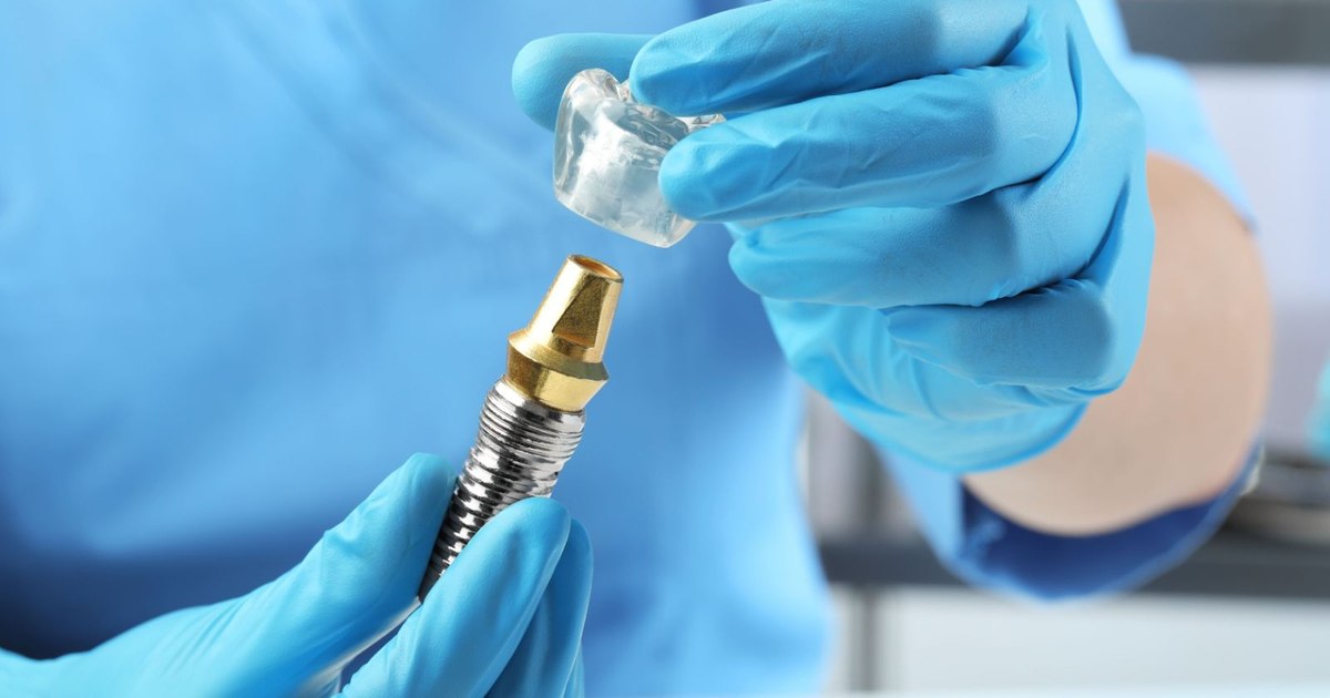 What is included in the price of a complete dental implant: From the consultation to the final control
