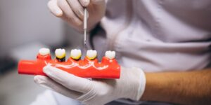Can you benefit from a dental implant if you have periodontitis?